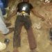 Kinshasa : Un criminel décède après une opération ratée