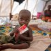 RDC/Lomami: Plus de 600 enfants touchés par la malnutrition à Bwaka Mulumba