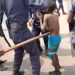 Répression de la marche de l’opposition : Félix Tshisekedi attendu dans l’hôpital où l’enfant mineur brutalisé et tabassé par la police est interné !