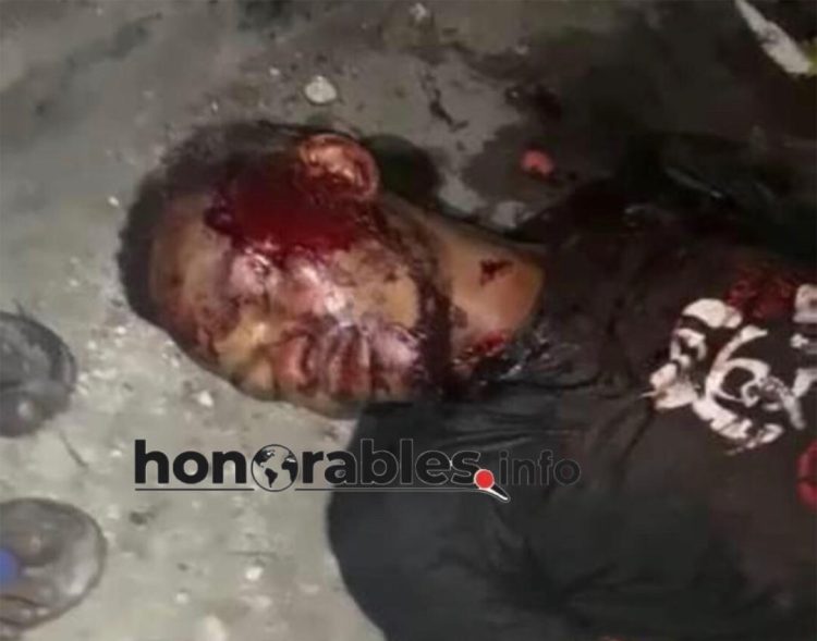 URGENT : Faisant un débat sur le concert de Ferre Gola , un jeune a été poignardé à N’djili !
