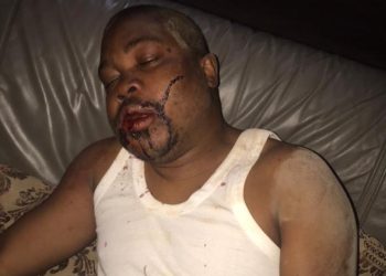 RDC : Augustin Matata Ponyo dénonce l’attaque contre son frère à Lubumbashi !