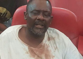 RDC : Frank Diongo entre la vie et la mort, le docteur Mukwege dénonce !