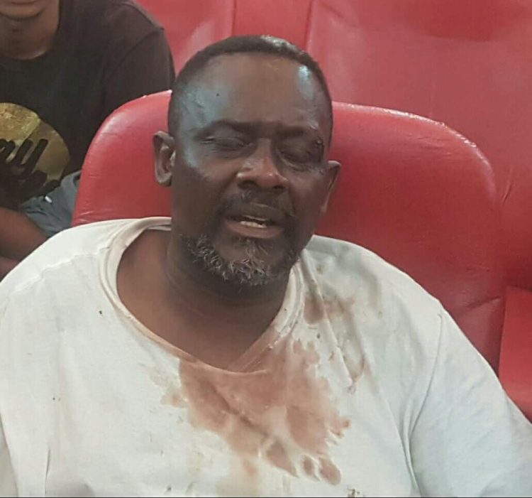 RDC : Frank Diongo entre la vie et la mort, le docteur Mukwege dénonce !