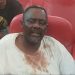 RDC : Frank Diongo entre la vie et la mort, le docteur Mukwege dénonce !