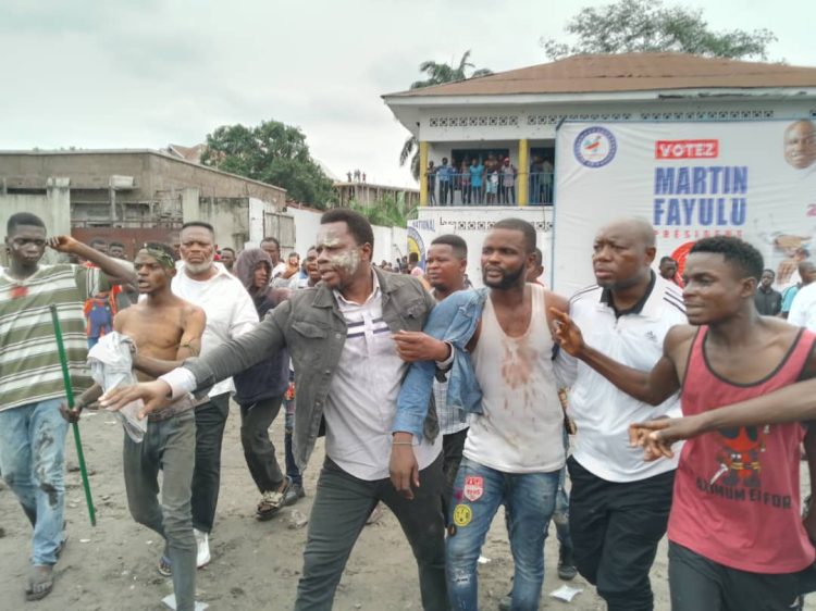 Élections 2023 | Plusieurs blessés graves lors de la marche de l’opposition de ce mercredi !